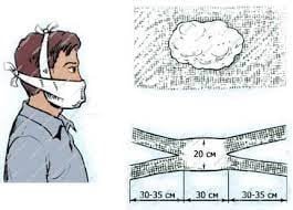 Хімічна атака