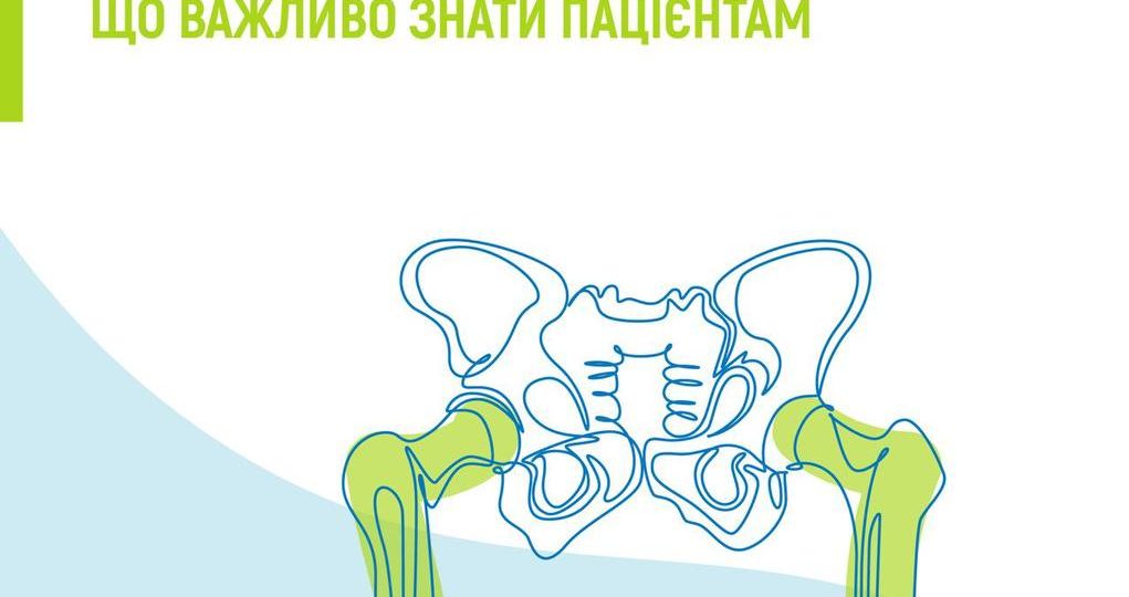 Ендопротезування за ПМГ: що важливо знати пацієнтам