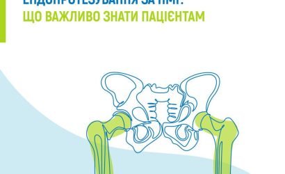 Ендопротезування за ПМГ: що важливо знати пацієнтам